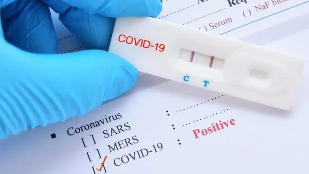 Covid 19 Test Sonucu Nasil Ogrenilir E Nabiz Covid 19 Test Sonucu Sorgulama Ekrani Takvim