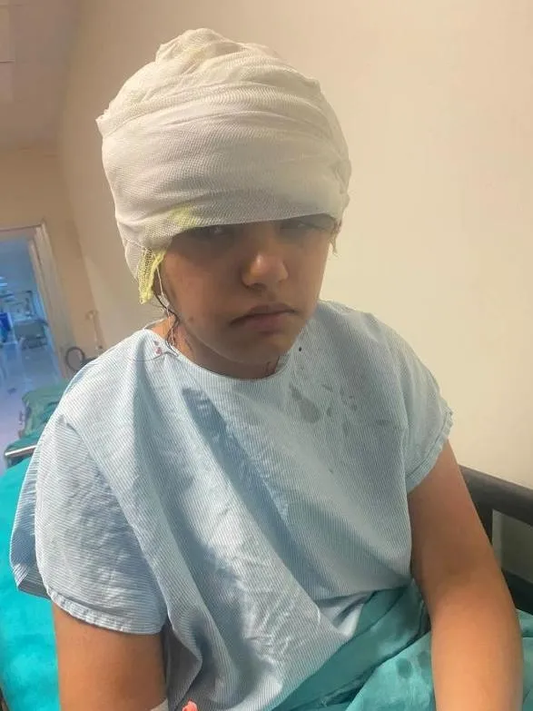 antalyada-go-kart-faciasi-saci-tekerlege-dolaninca-kafa-derisi-yerinden-siyrildi-1694360013777.jpeg Antalya'da Go-kart faciası! Saçı tekerleğe dolanınca kafa derisi yerinden sıyrıldı: Genç kız ölümden döndü-3