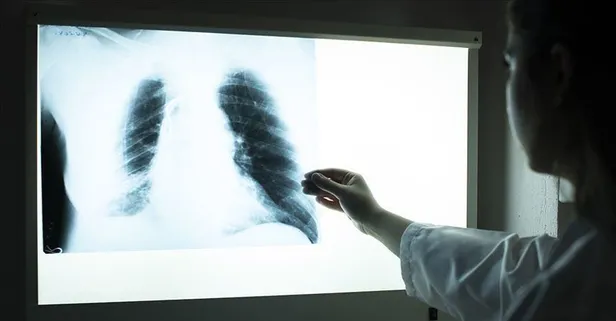 Hırıltılı nefes KOAH demek! Doğru tedavi ile şikayetler azalıyor