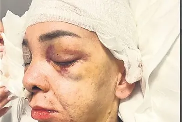 Kocaeli’de eğlence mekanında dehşet: Anne ve oğlunu darp eden şüphelilerin ifadesi ortaya çıktı