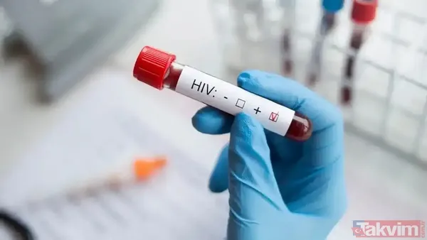 İzmir'de 13 yaşındaki çocuk AIDS’ten öldü | Babanın ifadesi ortaya çıktı! Cinsel istismarla mı bulaştı? İl Sağlık Müdürlüğü'nden açıklama - 2