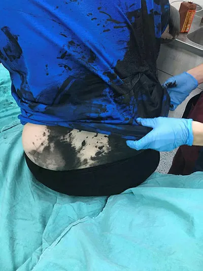 Darp edip üzerine siyah sıvı dökmüşlerdi! O olayda flaş gelişme-1