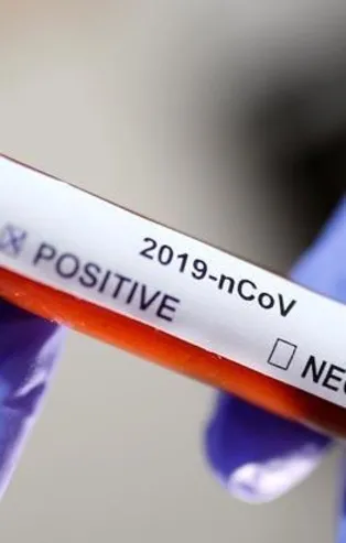 Türkiye'de 23 Nisan koronavirüs vaka sayısı kaç oldu? Rekor iyileşme: 2.104