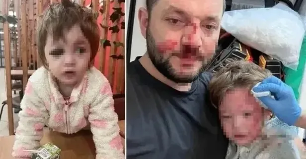 Scooter silah sayıldı: 14 aylık bebeğe saldırıya 36 yıl hapis