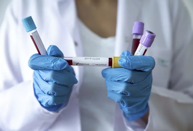 Hayat kurtaran tablo! TAKVİM, grip, soğuk algınlığı ve alerji ile Corona virüsü arasındaki farkı ortaya çıkardı-25