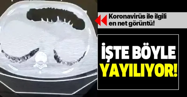 Koronavirüs işte böyle yayılıyor! Bunu daha önce hiç görmediniz!-1
