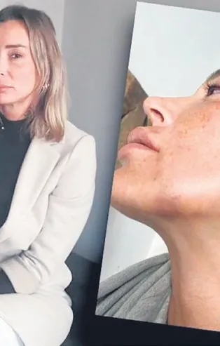 Eski sevgilisini Burcu Can Eşmen darp eden Emre Özer hakkında 16 yıl hapis cezası istendi