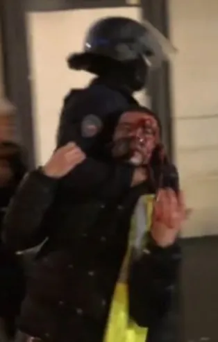 Fransa'da polis şiddeti giderek artıyor