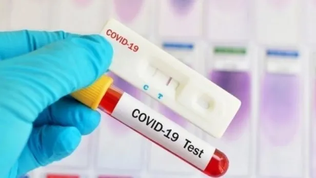 THY ve Pegasus uçaklarında PCR testi zorunluluğu kaldırıldı mı yoksa devam ediyor mu? Uçuşlarda PCR testi kalktı mı?-2