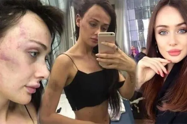 Sırp model Tanja Dukiç'in darbedilmesi davasında flaş gelişme: Dosya uzlaşma büroya gönderildi