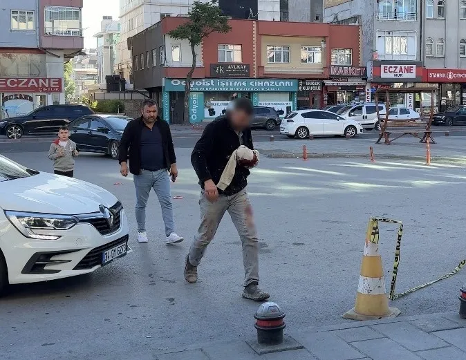 bayramin-ilk-gunu-acemi-kasaplar-acile-kostu-1779867401096.jpg Bayramın ilk günü acemi kasaplar acili doldurdu: “13 dakikada keserim” dedi, kendini yaraladı-7