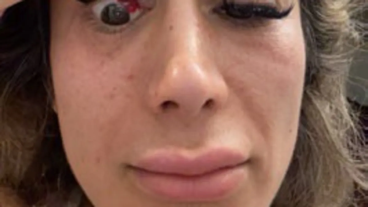 İstanbul’da fitness eğitmeni tavuk dönerden zehirlendi!