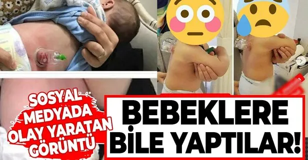 Sosyal medyadaki hacamat görüntüleri olay yarattı: Bebeklere bile yaptılar! Uzmanlardan kritik uyarı