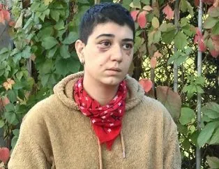 Böyle canilik görülmedi! Beyoğlu’nda 23 yaşındaki Zehra Meraklı’yı felç eden dayak