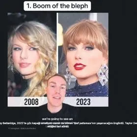 Gözünün şeklini değiştirdi