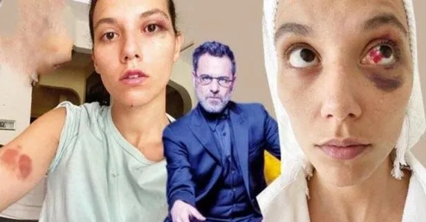 Ozan Güven’e destek olan Gökhan Özoğuz ve Vedat Özdemiroğlu’na sosyal medyadan tepki: İkiyüzlüler, ahlaksızlar