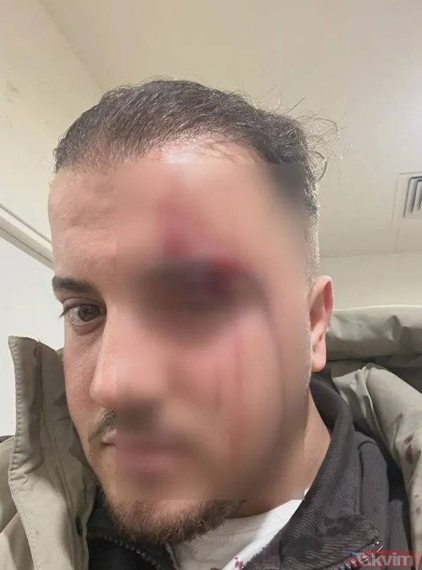 Eyüpsultan'da "yol verme" kavgası! Önce darbetti sonra tanımazlıktan geldi: Buyur kardeşim - 9