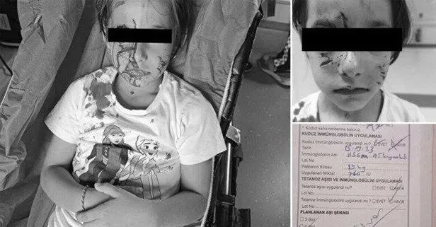 Esenyurt’ta başıboş köpek çocuğun yüzünü parçaladı! İstanbul Valiliğinden ’kuduz’ haberlerine ilişkin açıklama geldi: Gerçeği yansıtmamaktadır