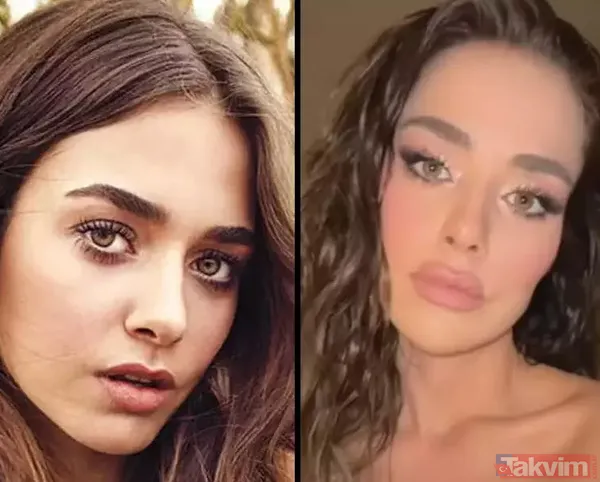 Bensu Soral "Hiç estetiğim yok kendimi güzel bulmuyorum" dedi ortalık birbirine girdi "Tabi biz de yedik" Yüzündeki değişim çok konuşulmuştu - 7