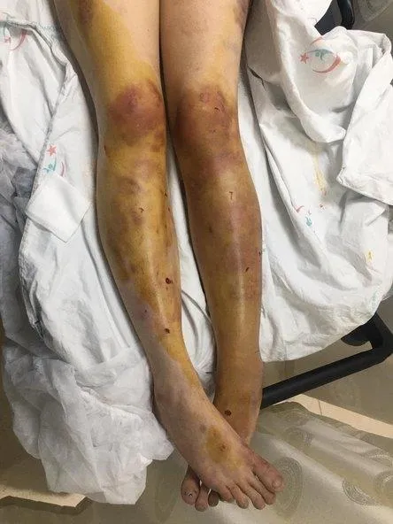 Şanlıurfa'da kan donduran olay! İmam nikahlı eşini odaya kapatıp 5 gün boyunca...-2