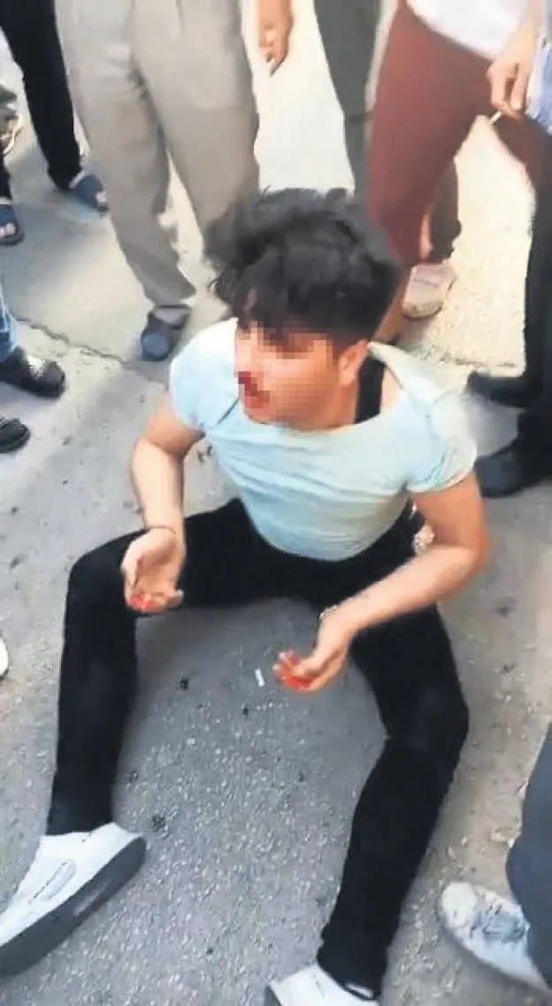 Sapığa meydan dayağı! Eliniz dert görmesin