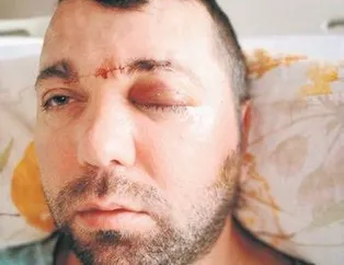 Sıra’dişi’ skandal