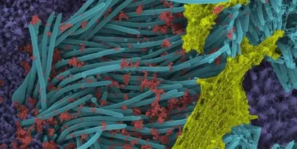 Koronavirüsün son hali görenleri korkuttu! Kıla benzer enfekte hücreler...-2