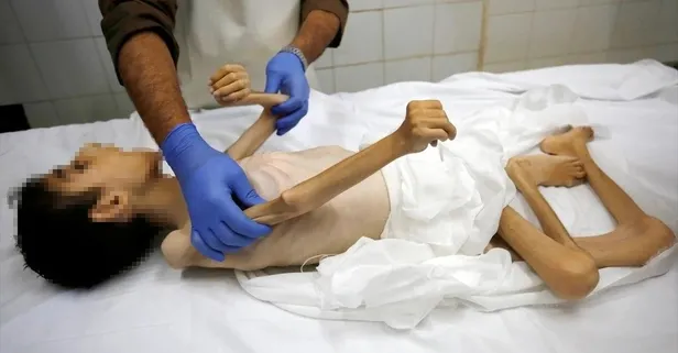 İsrail 13 yaşındaki Abdulkadir es-Serhi'yi açlıktan öldürdü!