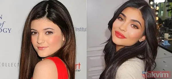 Bella Hadid ve Şeyma Subaşı'nın idolü Hailey Baldwin'in estetik açıklaması olay: Yüzüme asla dokunmadım! - 21