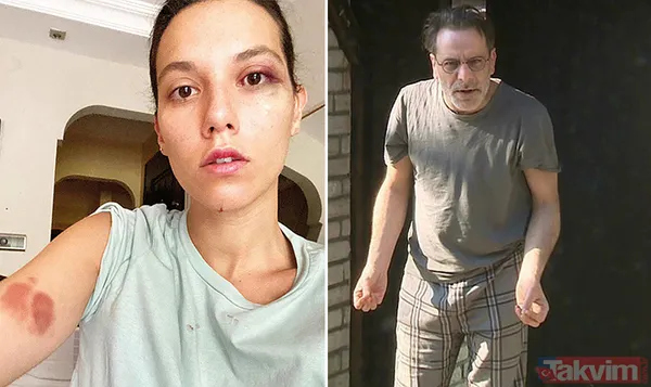 Bulutsuz, Kendisine Şiddet Uyguladığı Gerekçesiyle Güven Hakkında Suç Duyurusunda Bulunmuş Ve 2 Ay Uzaklaştırma Kararı Aldırmıştı. Ozan Güven, Avukatı...