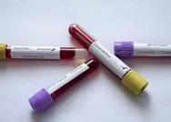 Koronavirüs salgınında son durum: 1.313 yeni vaka var