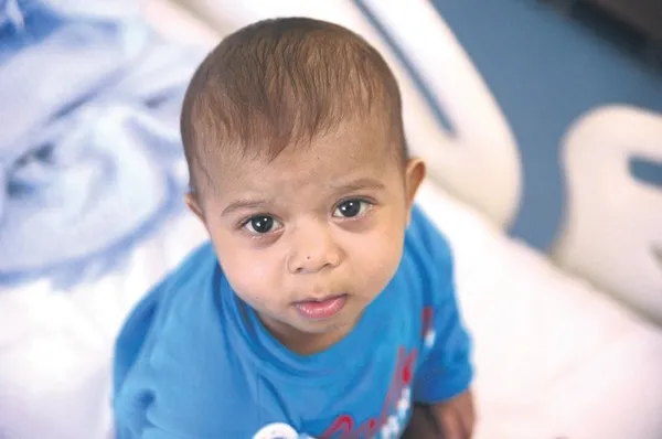 Suriyeli 16 aylık bebek, yaşam mücadelesiyle destan yazdı: Türk hekimlerinin başarılı operasyonuyla sağlığına kavuştu-3