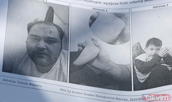 Antalya'da bir babanın iddiaları duyanları şoke etti! Parmaklarında yanık izleri, bileklerinde morluk... - 9