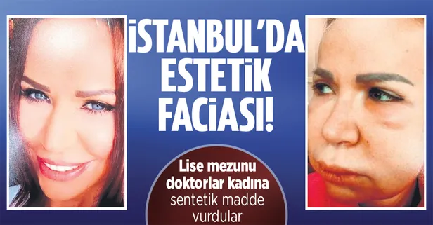 Merdiven altı estetik merkezleri dehşet saçtı! Talihsiz kadının yüzüne sentetik uygulamışlar