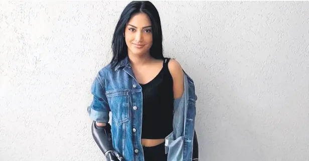 Diş teknisyeni Beyza Doğan kol ve bacaklarını kaybetti! Yeniden hayata tutundu