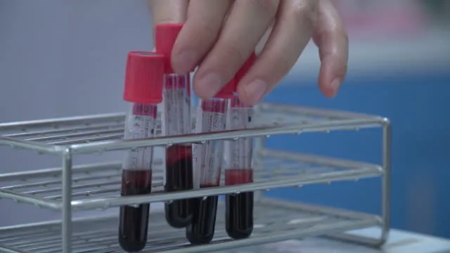 Bu kan grubundakiler çelik gibi vücuda sahip! En şanssız kan grubu belli oldu! Bu kişilerin kanser olma riski...-8