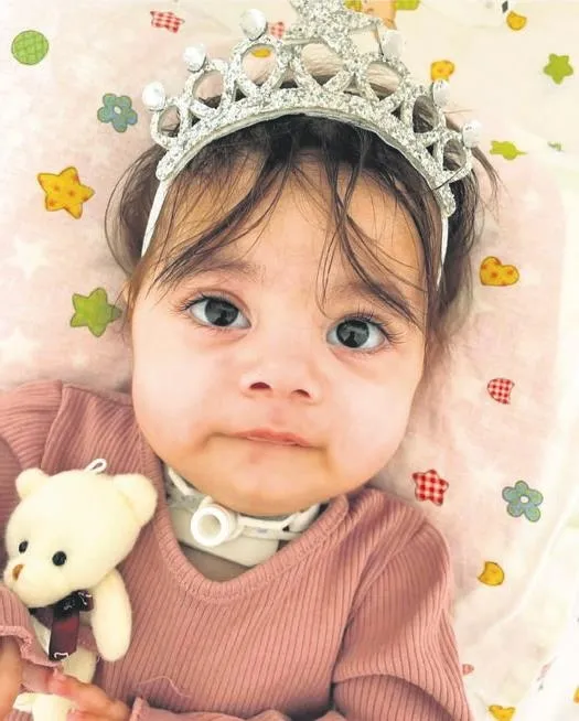 gozbebegi-premature-dogan-ikizlerden-arden-130-gun-gunluk-yasam-savasini-kazandi-1667431808758.jpeg Gözbebeği! Prematüre doğan ikizlerden Arden 130 gün günlük yaşam savaşını kazandı-7