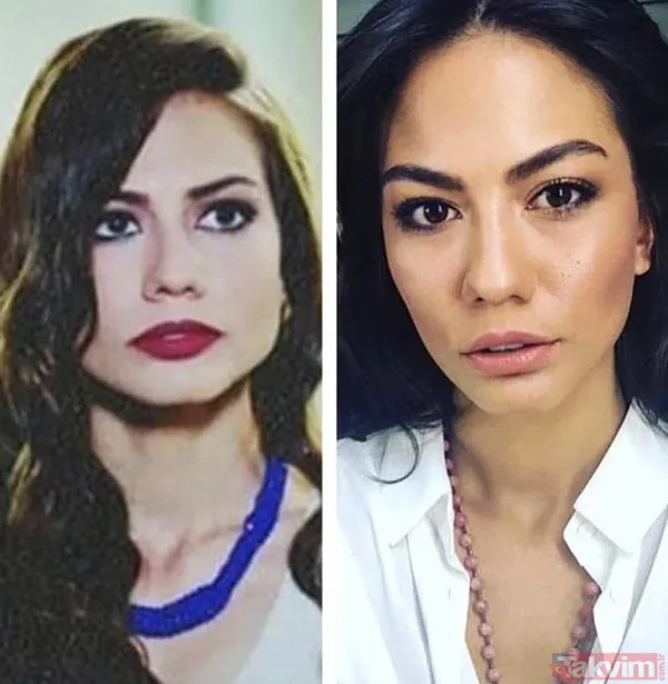 Demet Özdemir diyor ki doğal güzelim! Eski haliyle son hali arasında 2 farklı insan olan Demet Özdemir 'estetiğim botoksum yok' - 10