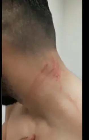 Amedsporlu 'jiletçi' Mansur Çalar uslanmıyor! Bir skandal daha