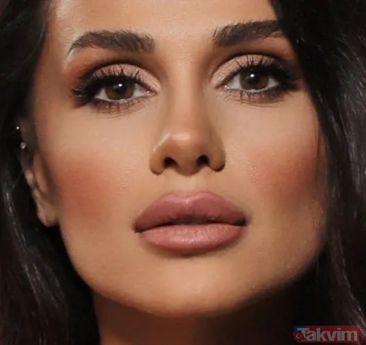 Aleyna Tilki’nin şiş dudakları olay oldu! Son halini gören dönüp bir daha baktı “Ajda Pekkan olma yolunda” - 13