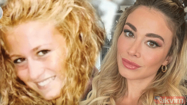 Can Yaman'ın sevgilisi Diletta Leotta estetik harikası çıktı hayaller yıkıldı! Görenler inanamadı doğal güzel sanılıyordu meğer… - 17