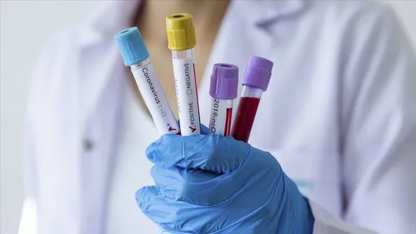 Çinli şirket Kovid-19 aşı adayının klinik denemelerini Suudi Arabistan'da yapacak-2