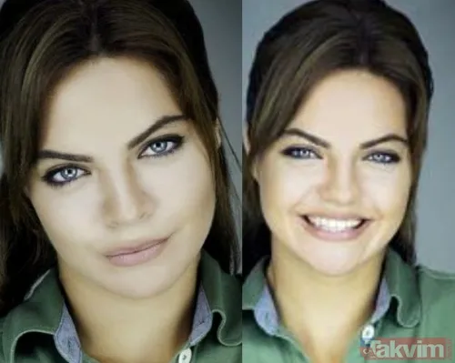 Danla Bilic sonunda bunu da yaptı, estetiğine estetik ekledi! Yüzünde yok yok - 28