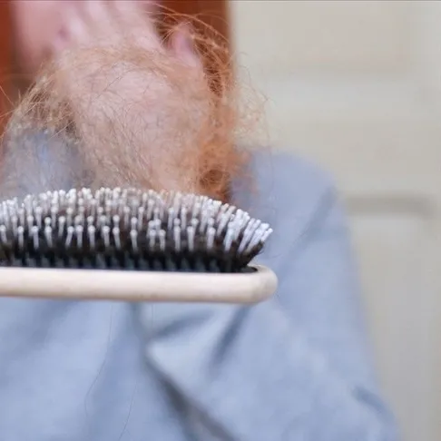 Çitle saçları besle