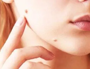 ’Ben’de olmaz deme!