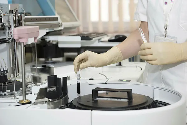 Bilim insanları ilk kez açıkladı! Koronavirüsten sonra yeni tehlike! 72 saat içerisinde... | Salmonella nedir? Salmonella belirtileri-8