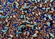 Koronavirüsün insan hücrelerindeki yayılışı mikroskopla görüntülendi