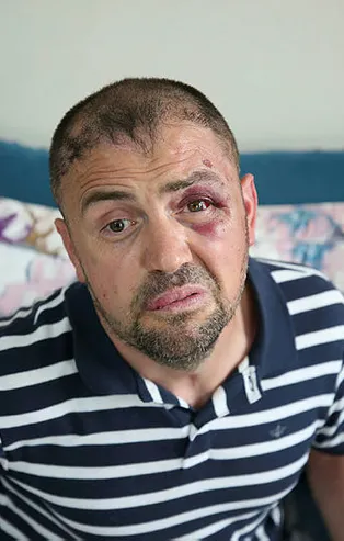 Bursa'da insanlık dışı olay! Terör gazisini öldüresiye dövdüler