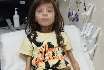 CEM MUHAMMET’TEN HABER VAR! Bursa’da çöp evde bulunmuştu! 16 ayda 18 kilo aldı ismi değişecek