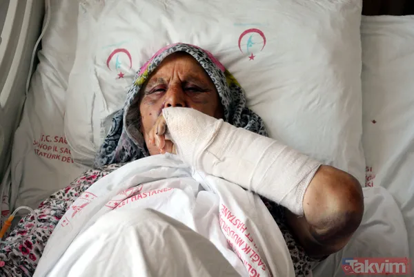 Kendisine para vermeyen anne ve babasını 2 saat boyunca baston koltuk değneği ve balta sapıyla dövdü - 5